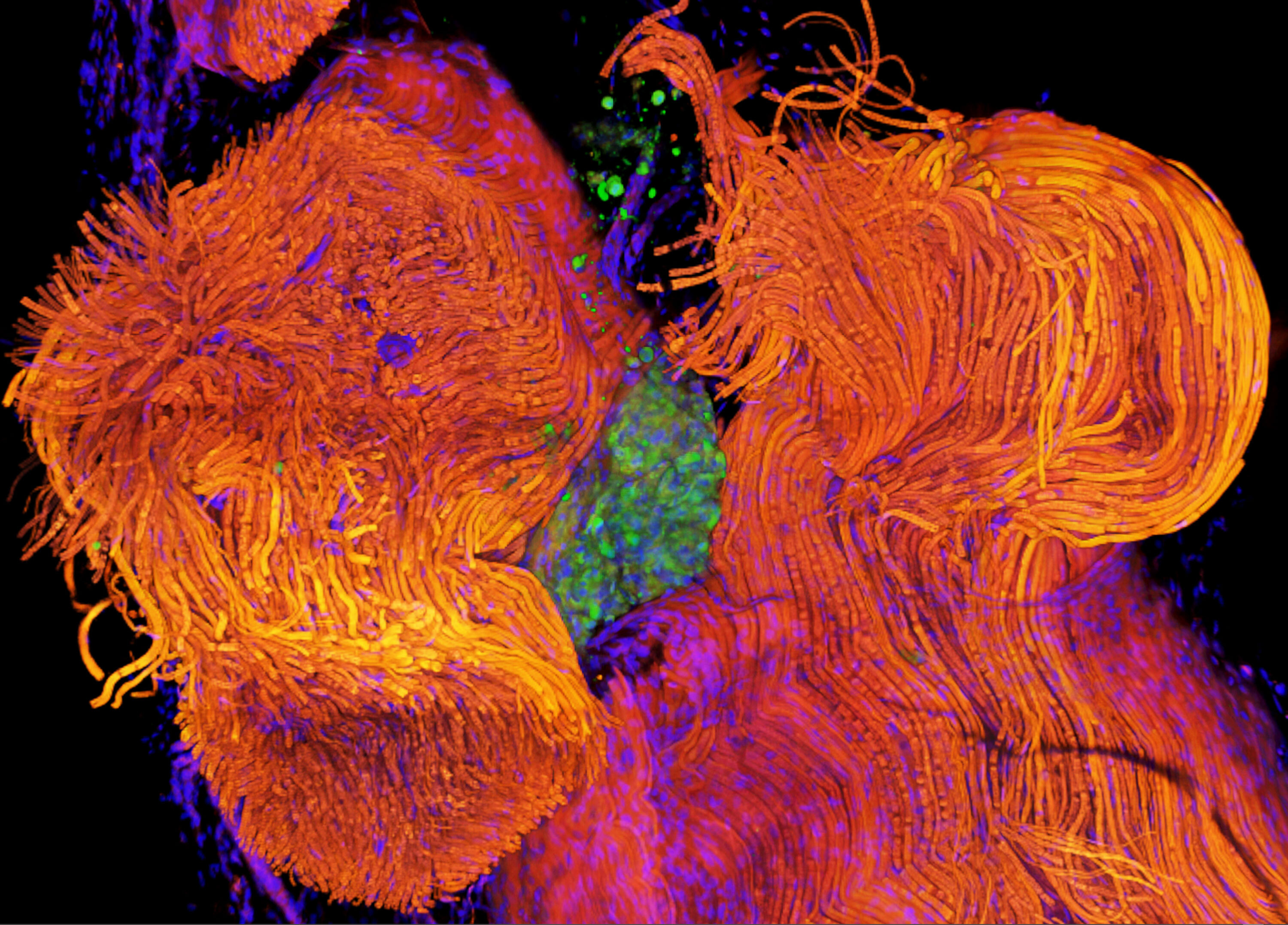 Cutting edge NTHU-Chang Gung research: micrograph showing transplant of 3D cell spheroids (green) into the sciatic nerve (orange) of rats.